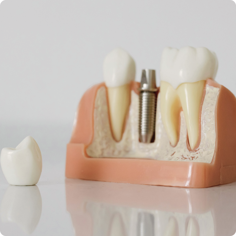 Implantology